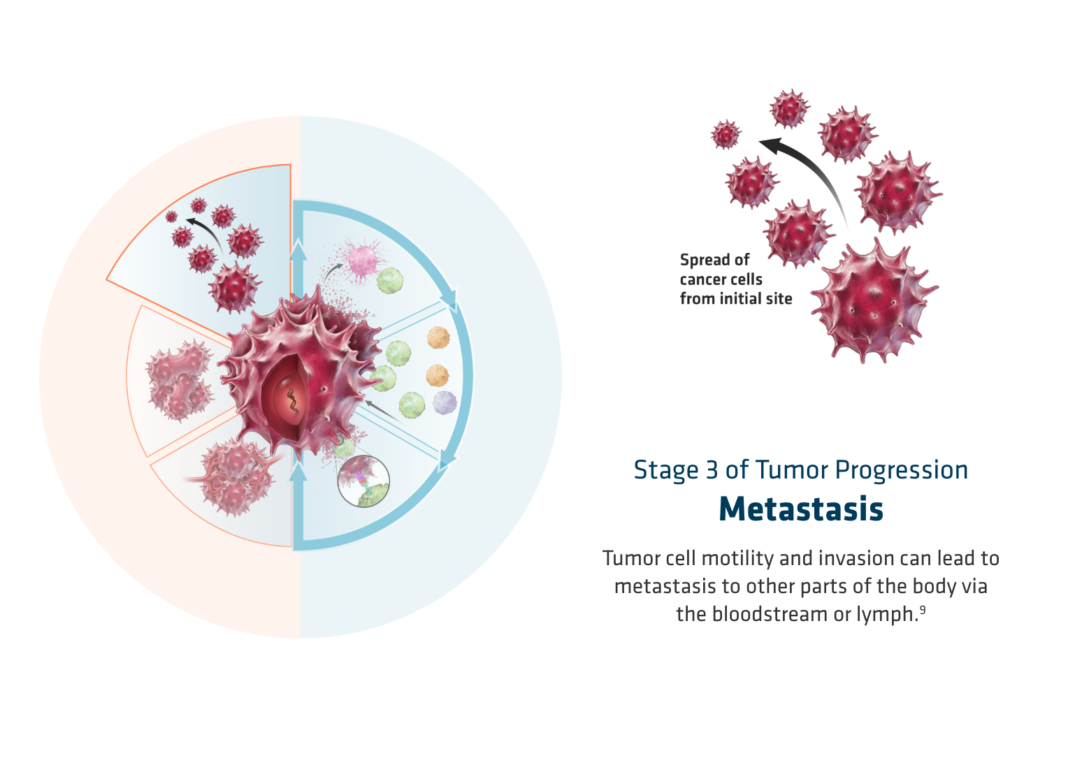 OPDIVO® (nivolumab) mechanism of action-  metastasis, graphic